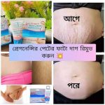 Anti Stretch Mark Cream - Image 3